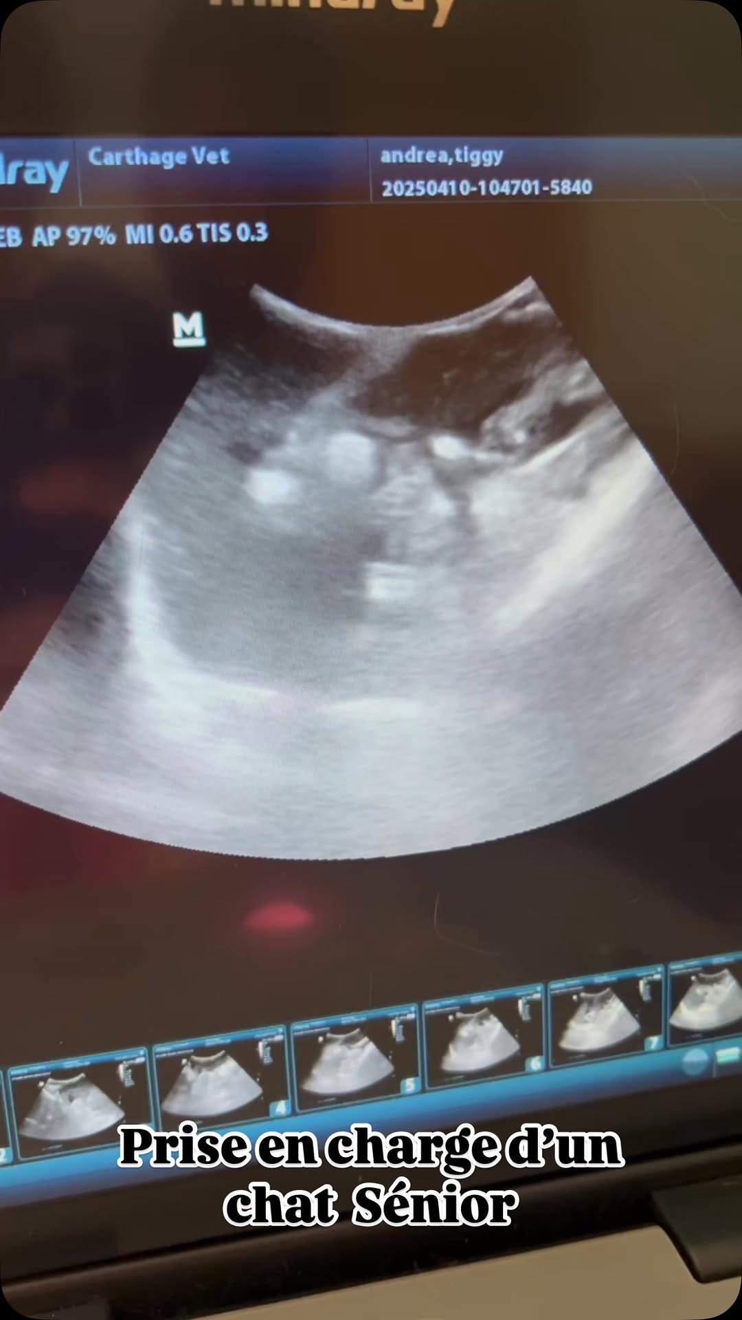 Aujourd’hui c’était le jour du bilan de santé de Tiggy, un chat 🐈‍⬛ sénior de 11 ans, qui a plusieurs problèmes de santé et qui nécessite un suivi régulier. 🩺

Au menu:
- bilan hépato-rénal complet 💉
- échographie abdominale 📟
- test rapide FelV-FIV-Corona 🩸

Si votre chat commence à prendre de l’âge, il est temps de prendre sa santé plus au sérieux. ⚠️ N’hésitez pas à demander conseil à votre vétérinaire 👩‍⚕️ qui saura effectuer les bilans nécessaires en fonction de son âge et de ses antécédents. 

#vetclinic #vetlife #dvm #veterinaryclinic #vets #veterinarymedicine #ultrasound #cats #catsofinstagram #vetdoctors #evocare #mindray #tunisia #carthagevet
